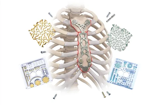 neurovascular